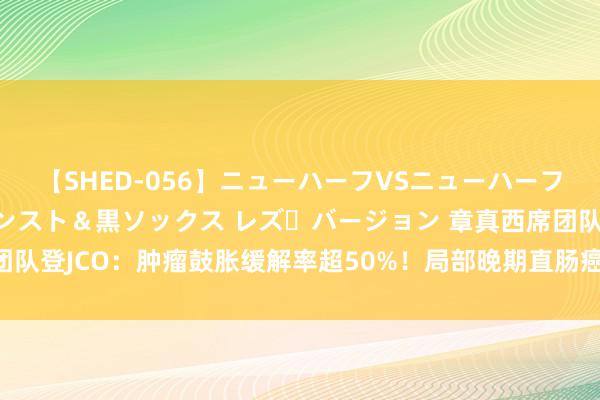 【SHED-056】ニューハーフVSニューハーフ 不純同性肛遊 3 黒パンスト＆黒ソックス レズ・バージョン 章真西席团队登JCO：肿瘤鼓胀缓解率超50%！局部晚期直肠癌患者“保肛”调养新聘用